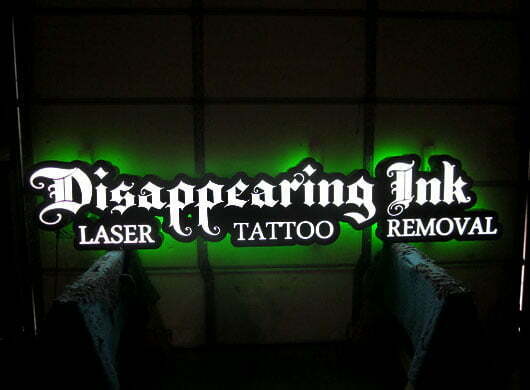 Disappearing Ink Laser tattoo removal